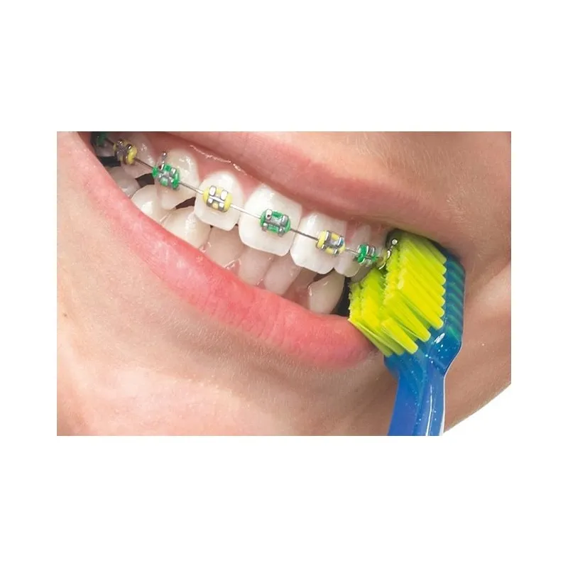 CURAPROX Periuta Ortodontica pentru aparat dentar 5460 Ultra Soft, 1 bucata
