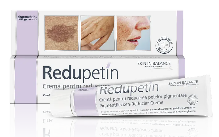 Redupetin crema depigmentanta x 20 ml (Zdrovit)
